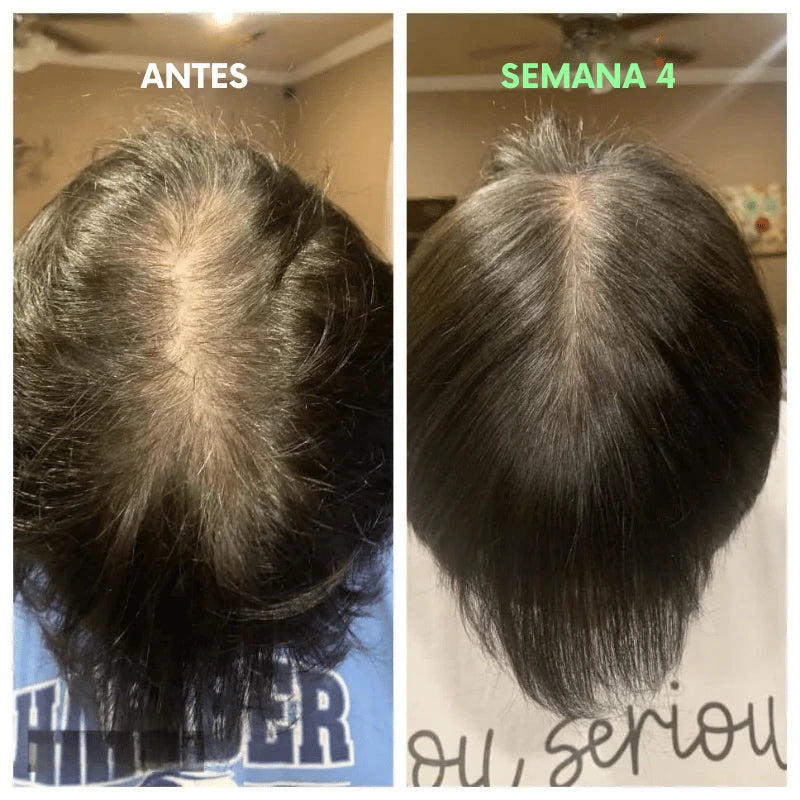 Shampoo y Acondicionador para el Crecimiento y Fortalecimiento del cabello | Proteína de Agua de Arroz