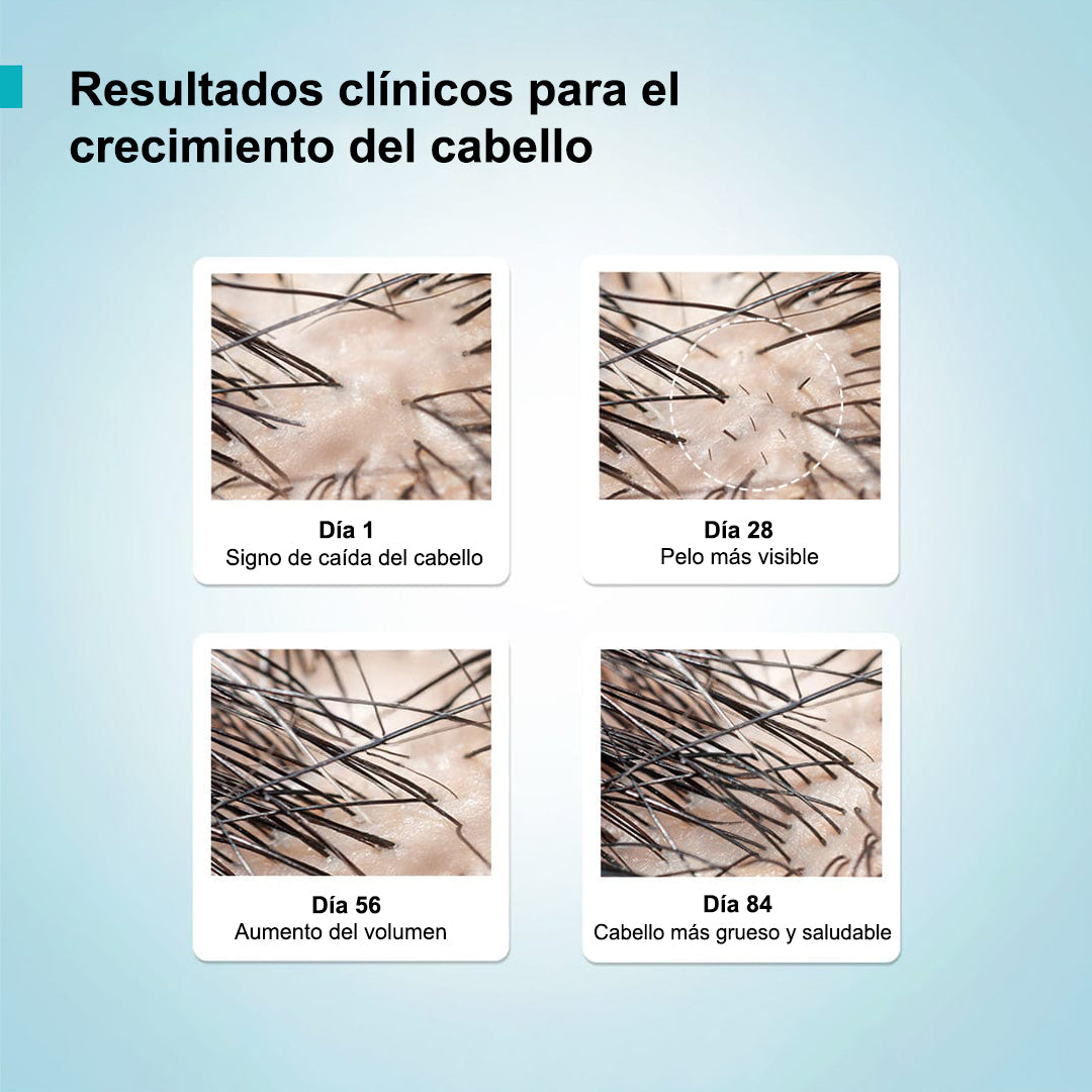 Sérum de crecimiento capilar I Frená la caída ya y recuperá tu pelo! Aumenta la densidad visible en 14 días