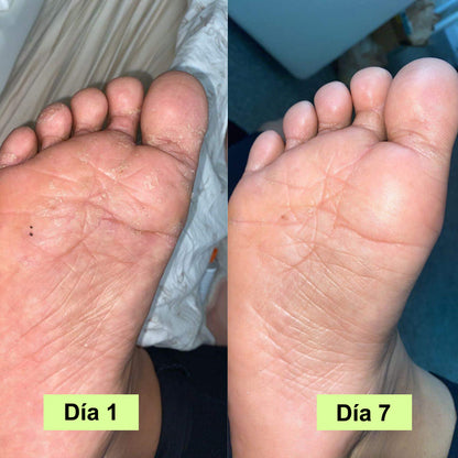 Jabón antihongos I Elimina el olor en tus pies