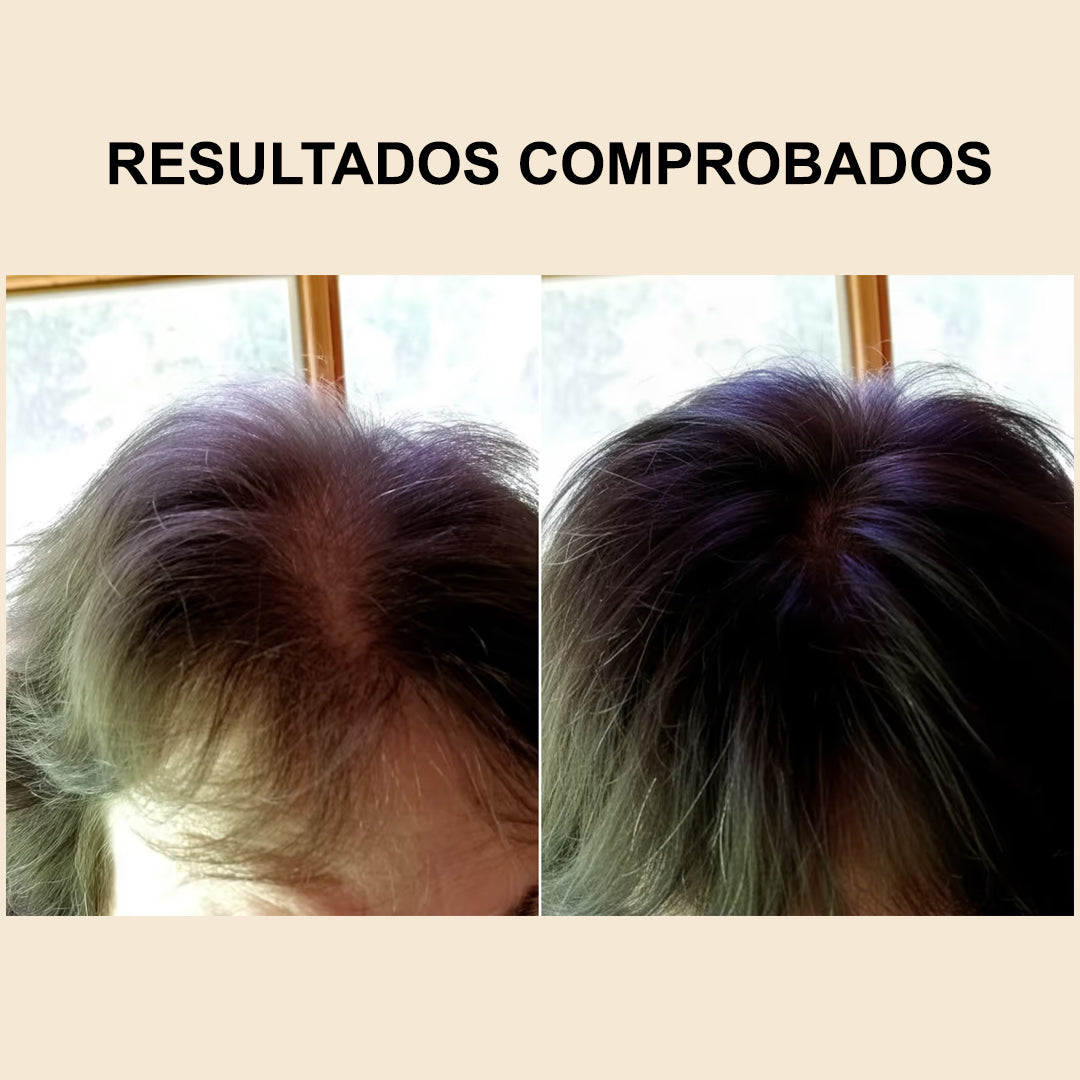 Spray Capilar | Menos caída diaria