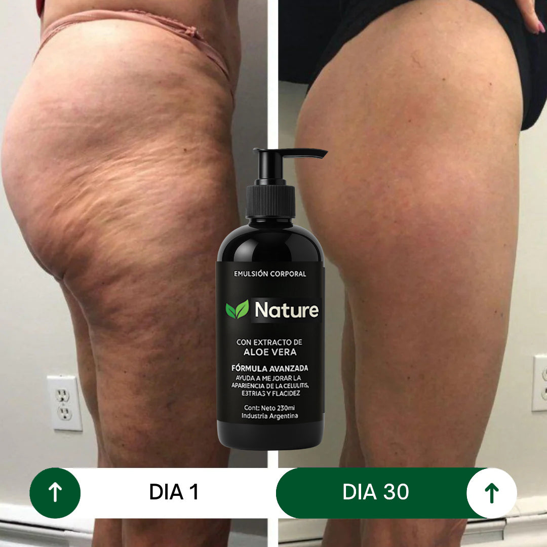 Tratamiento para Celulitis, Flacidez y Arrugas |  Reafirmante