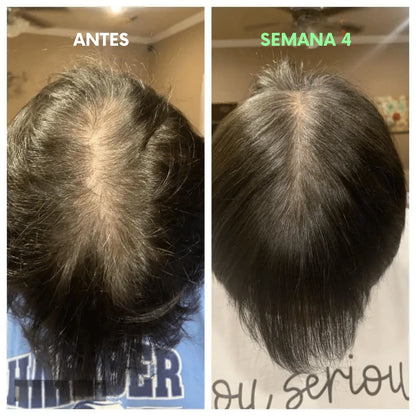 Shampoo y Acondicionador  para el Crecimiento y Fortalecimiento del cabello | Proteína de Agua de Arroz